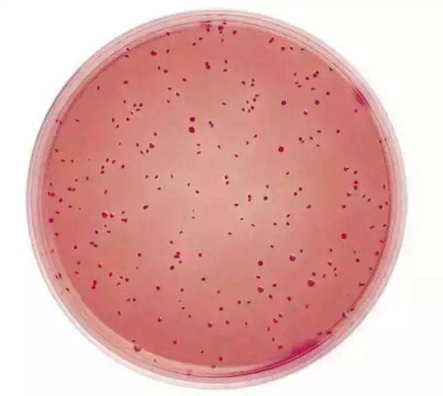 大腸菌群大菠萝导航在线观看